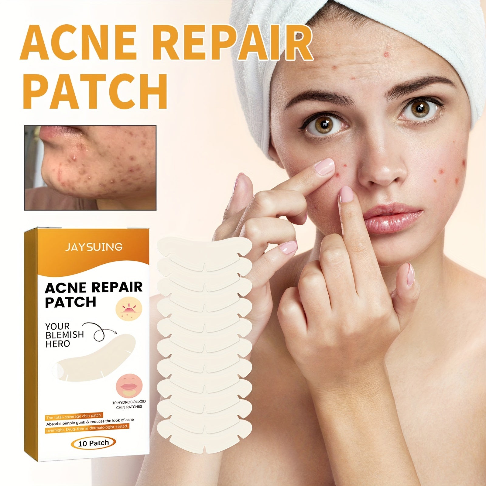 Hydrocolloid Acne Pimple Patch - Acne Cleansing Patch