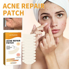 Hydrocolloid Acne Pimple Patch - Acne Cleansing Patch