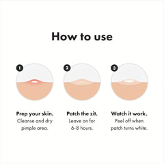Hydrocolloid Acne Patches - Cover Zits and Blemishes