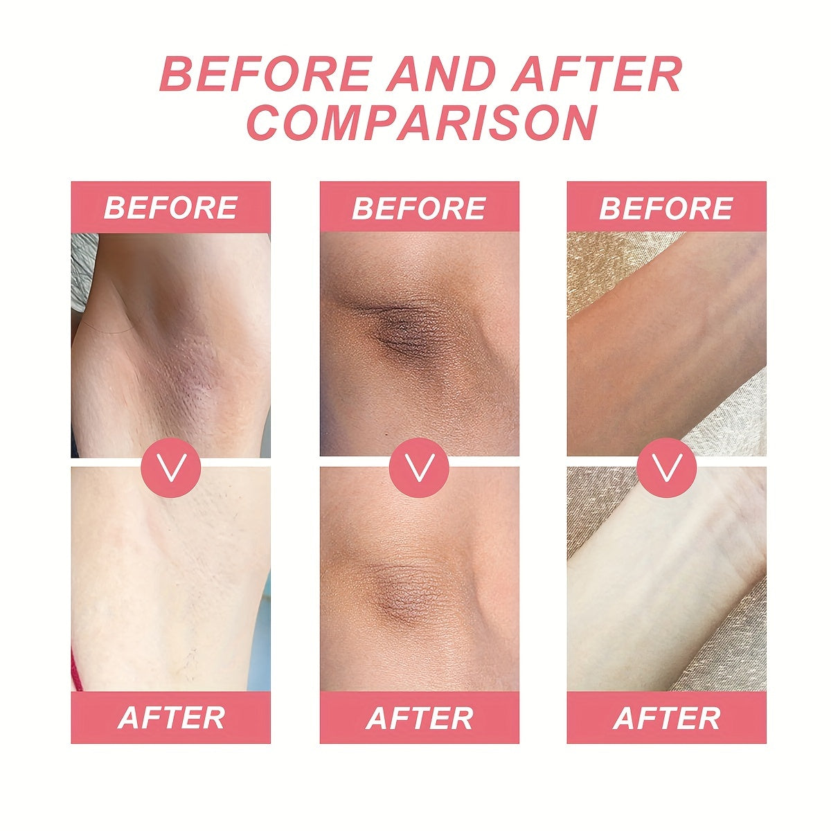 Rejuvenating Underarm Cream Moisturizer 50ml