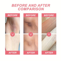 Rejuvenating Underarm Cream Moisturizer 50ml