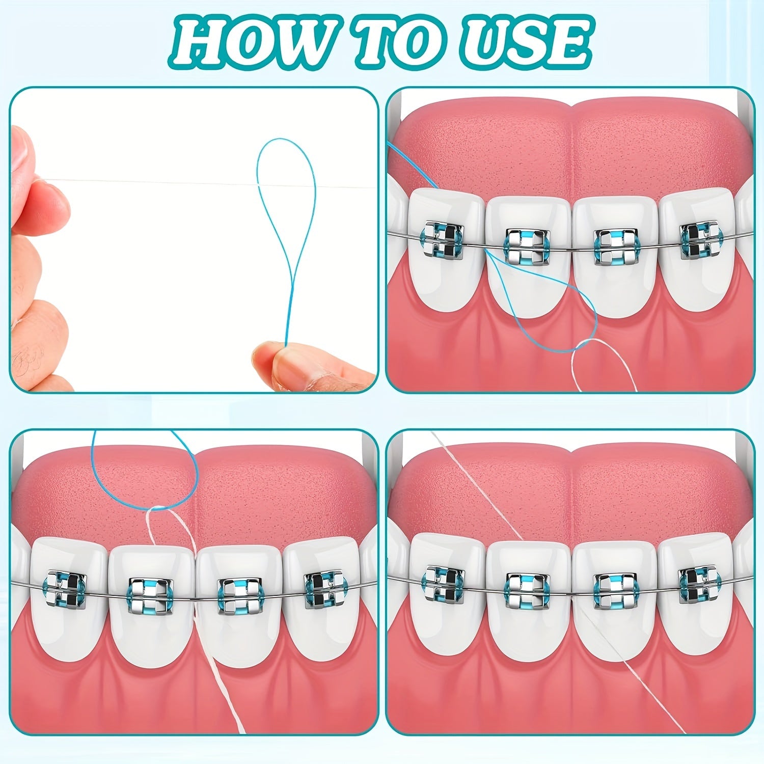 70 Dental Floss Threaders for Braces Bridges Implants