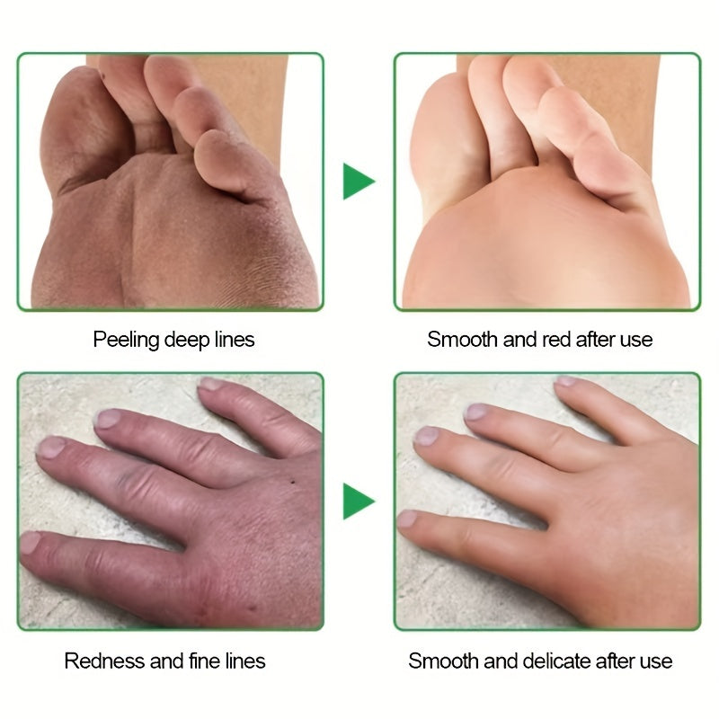Cracked Heel Cream for Dry Cracked Hands Feet