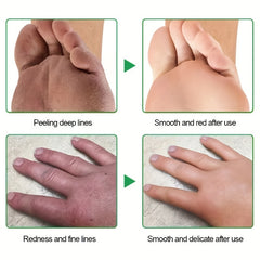 Cracked Heel Cream for Dry Cracked Hands Feet