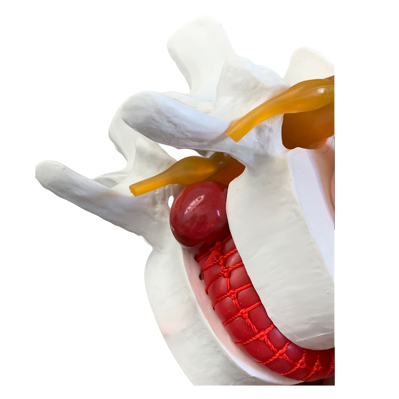 1pc Spine and Disc Model Lumbar Vertebrae Demonstration Teaching Aid