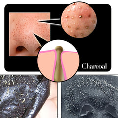 Bamboo Charcoal Mask for Clear Skin