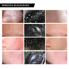 Bamboo Charcoal Mask for Clear Skin