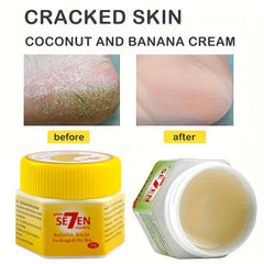 Banana Cream for Dry Feet 20g