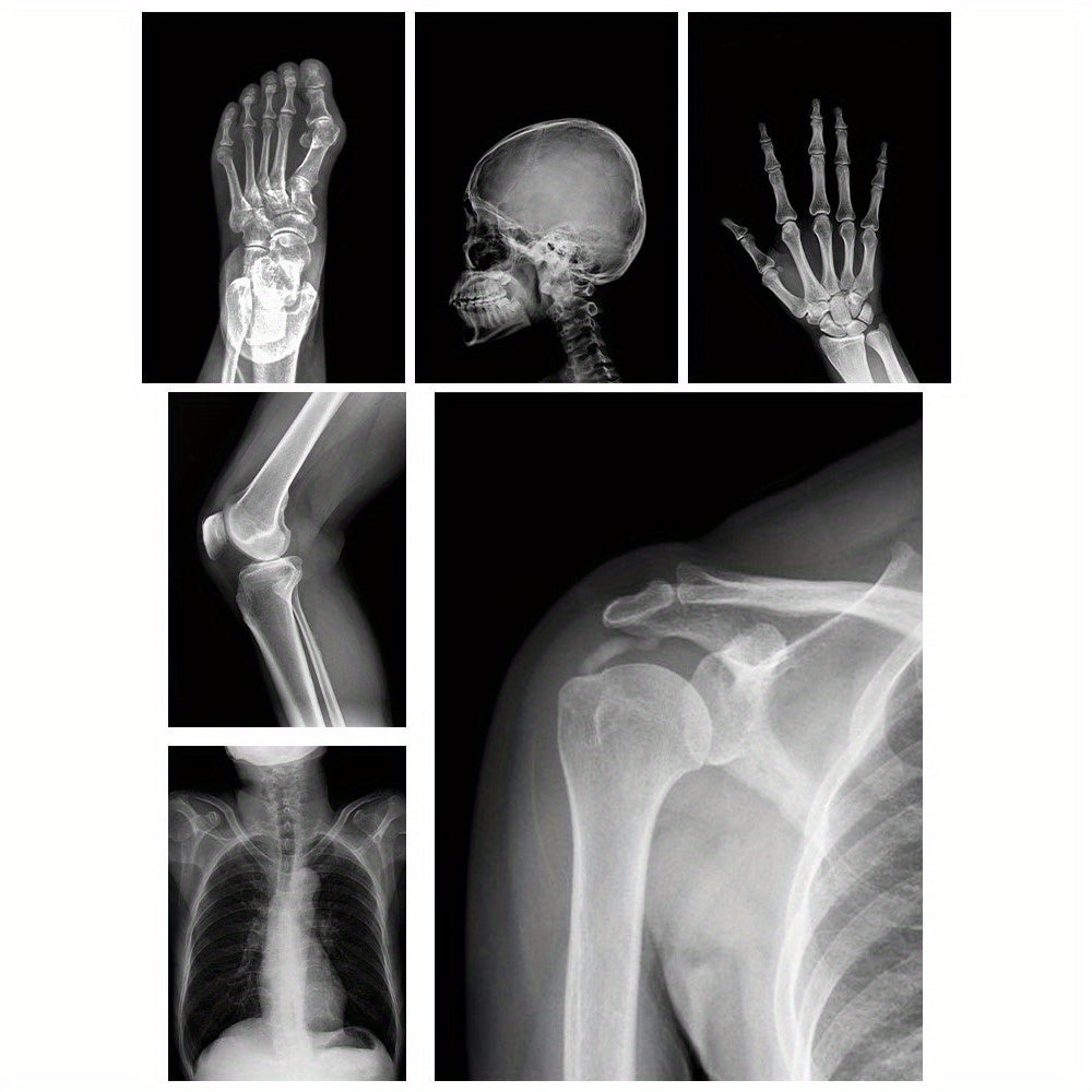 X-Ray Film Set for Human and Animal Science Study