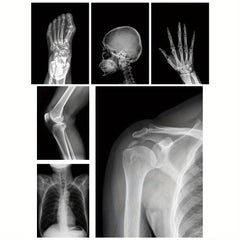 X-Ray Film Set for Human and Animal Science Study