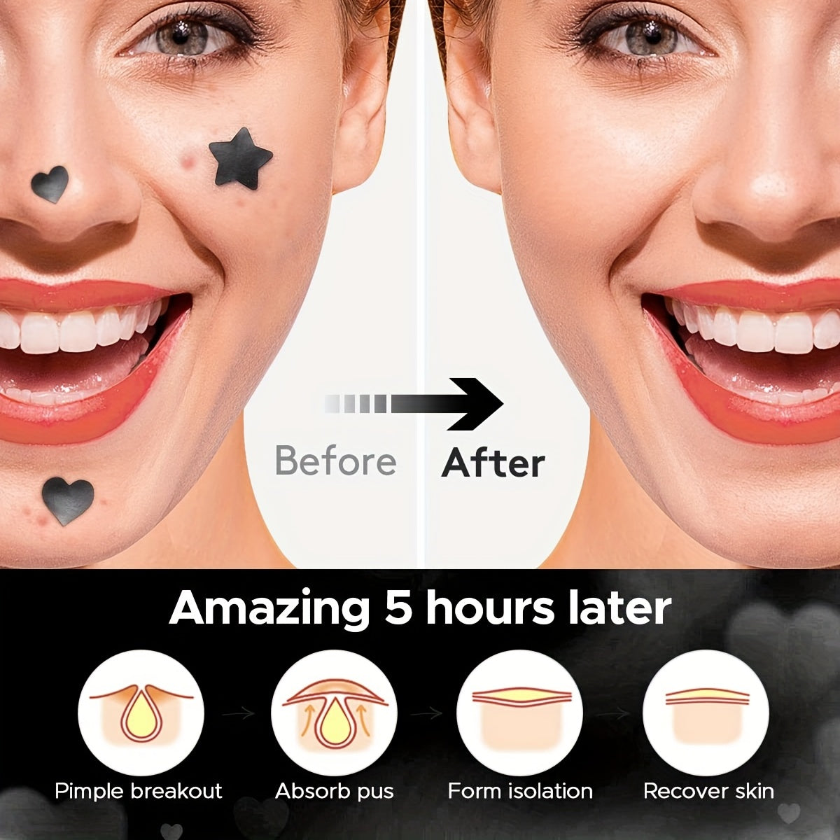 Star Shaped Acne Patch, Hydrocolloid Pimple Cover