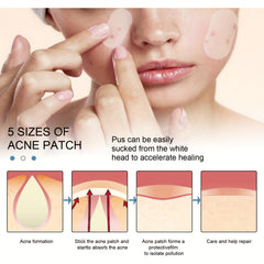 EELHOE Invisible Acne Patch 80 Stickers Waterproof Concealer