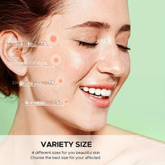 Hydrocolloid Acne Patches - Cover Zits and Blemishes