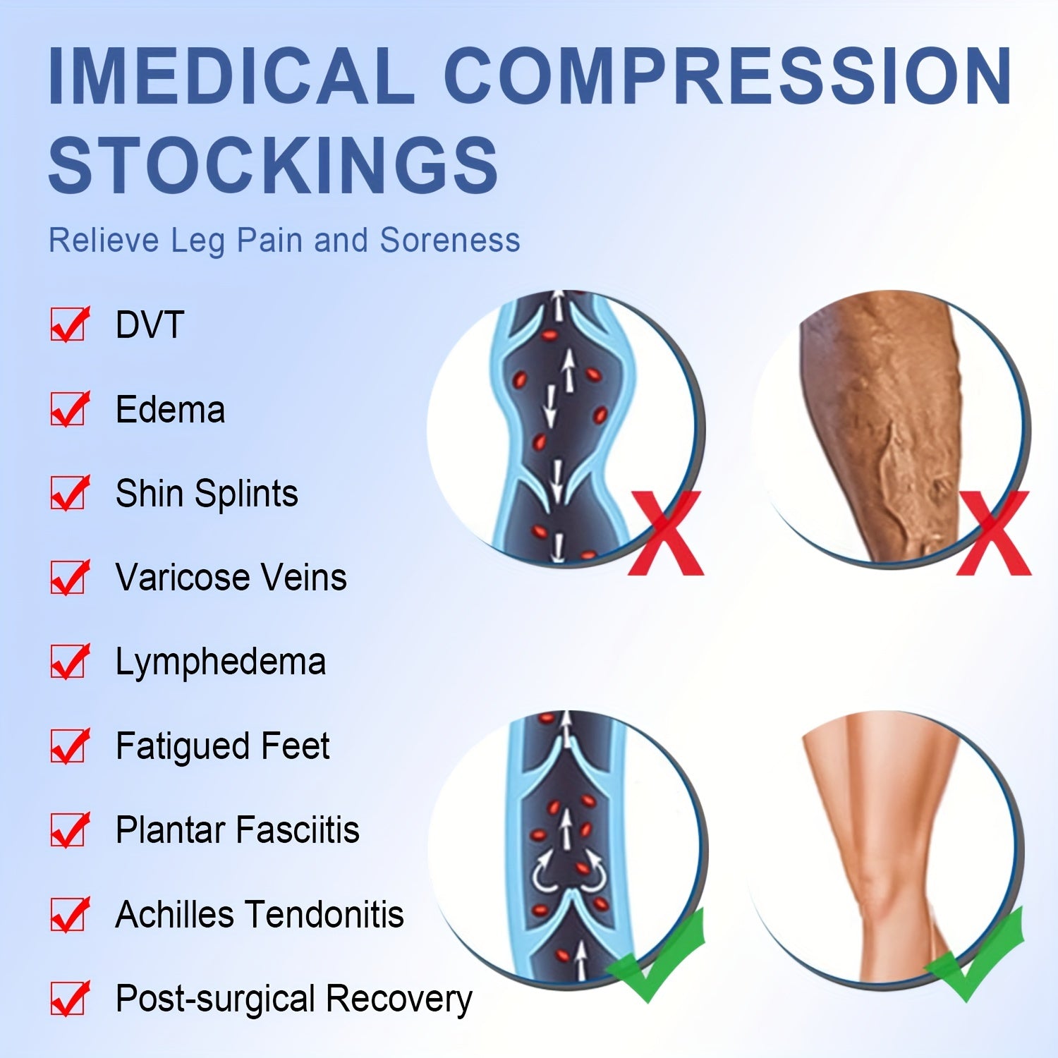 Size Up 15-20mmHg Anti-Thrombotic Compression Thigh Socks