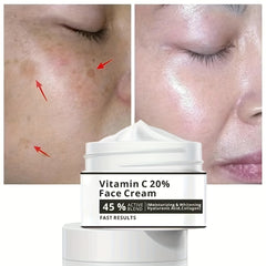 Moisturizing Freckle Cream for Smooth Skin