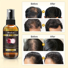 30ml Onion Hair Spray Stronger Thicker Hair