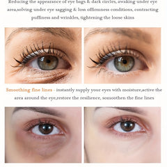 Vitamin C Eye Serum for Fine Lines & Wrinkles