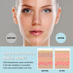 Facial Ice Roller for Puffiness and Skin Care