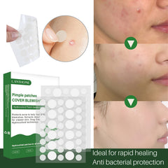 72 Pcs Pimple Patches Hydrocolloid Acne Stickers For Covering Zits Blemishes