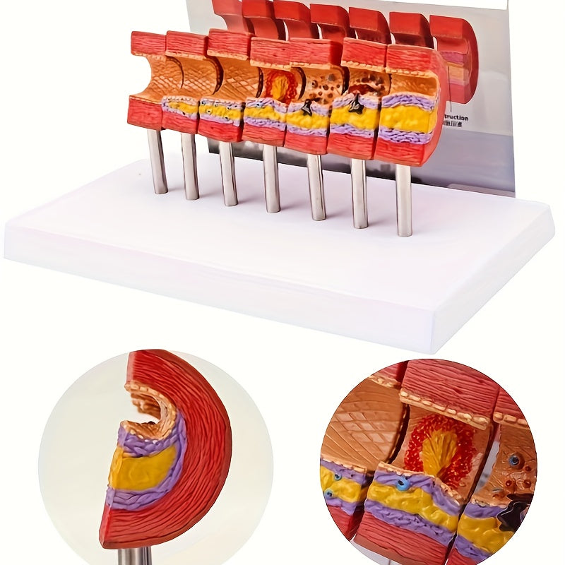Educational Arterial Sclerosis Model for Students