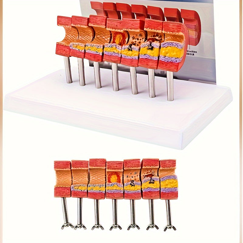 Educational Arterial Sclerosis Model for Students