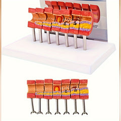Educational Arterial Sclerosis Model for Students