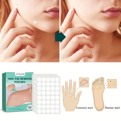 Acne Patches Hydrocolloid Acne Pimple Patch 120pcs