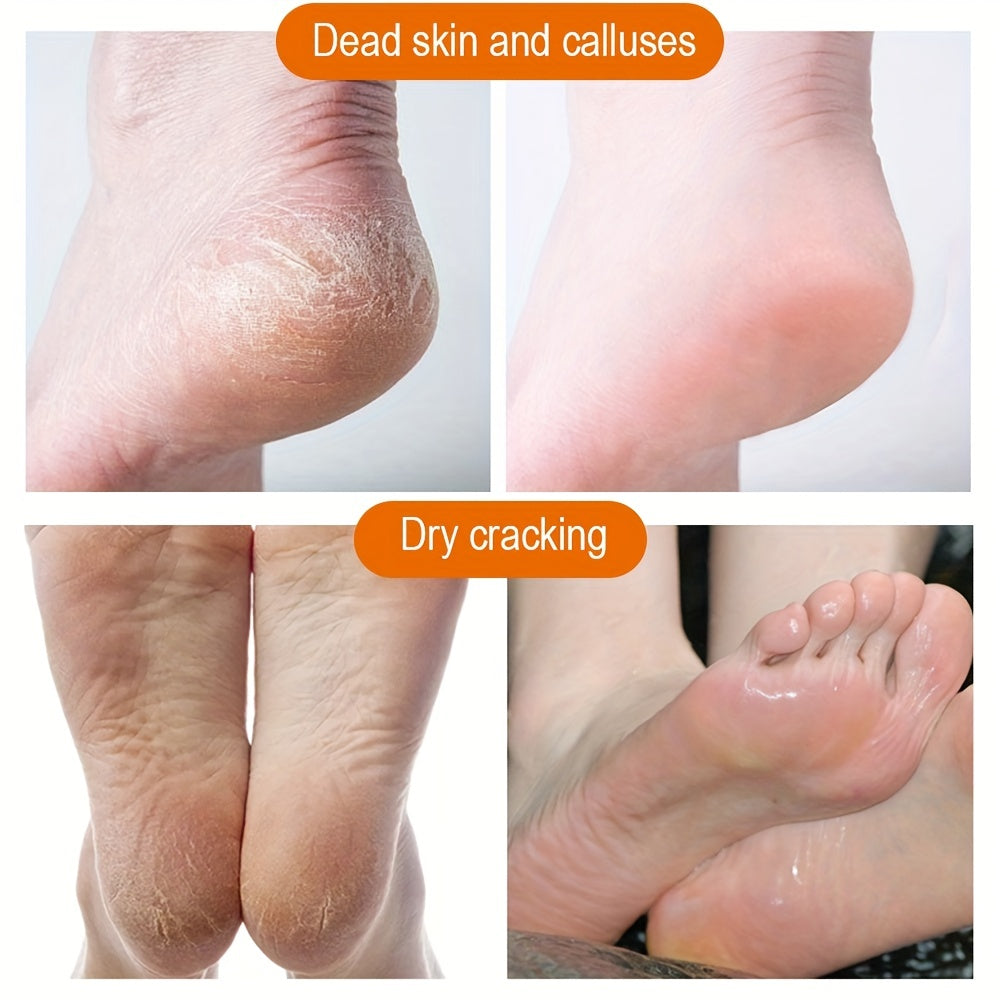 Anti Crack Cream for Feet - Softens Dead Skin and Calluses - 50g