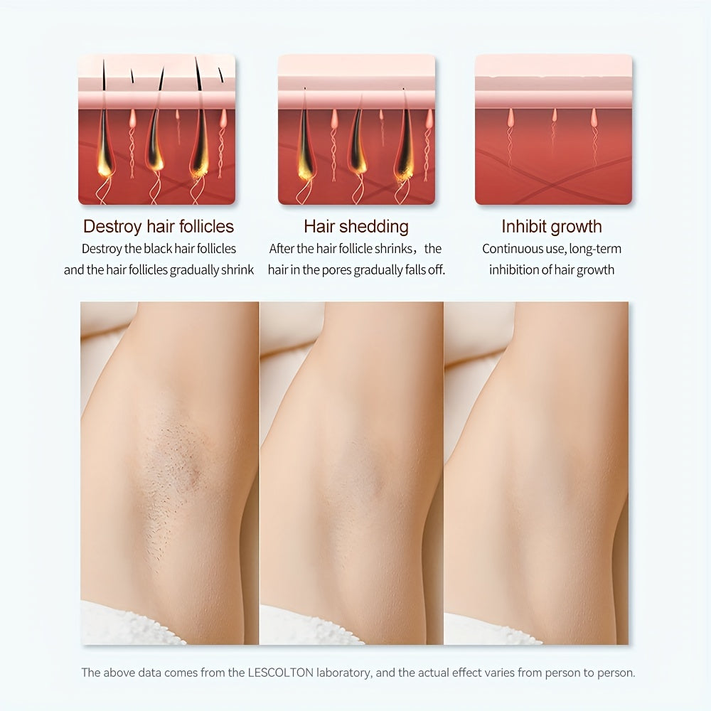 Laser Hair Removal Device - Permanent Hair Removal At Home