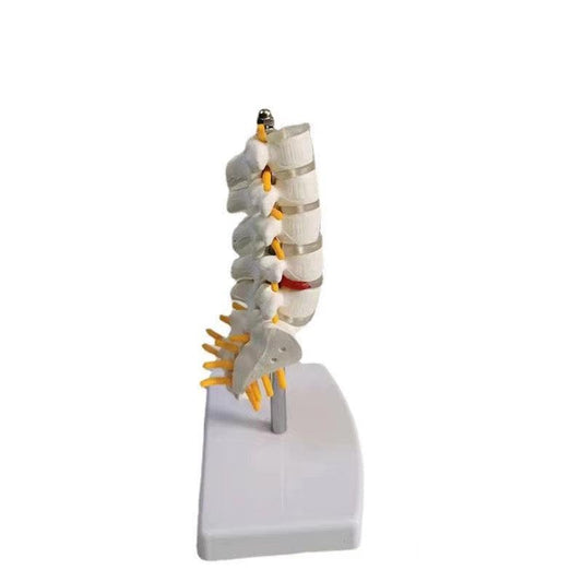 Lumbar Spine Model with Herniated Disc Sacrum & Nerves for Medical Education