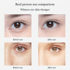 Eye Mask for Fine Lines Dark Circles Puffiness