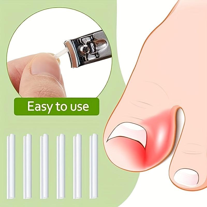 Ingrown Toenail Corrector Brace Strips Pedicure Tool Toenail Correction Patch