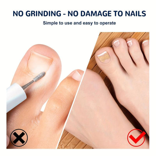 Ingrown Toenail Correction Stickers for Dark Skin Tone