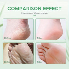 Foot Care Creams for Soft Feet
