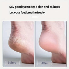Pedicure File Tool for Smooth and Soft Feet