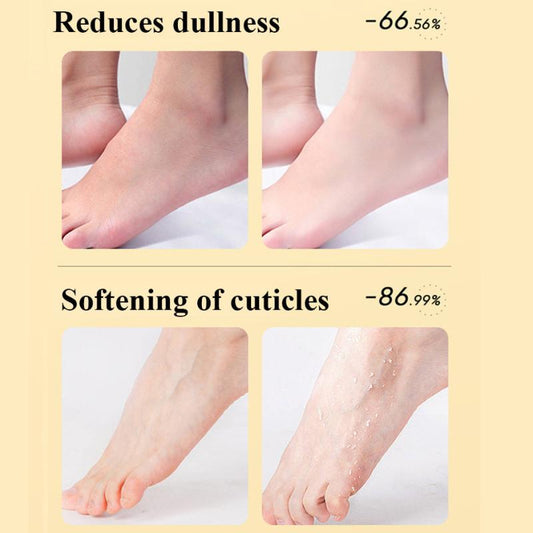 180g Foot Exfoliating Cream Dead Skin Remover
