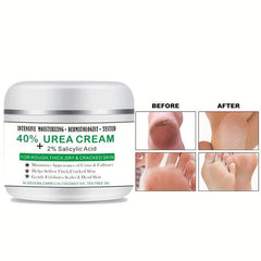 Urea 40 Foot Cream + Salicylic Acid - Callus Remover for Feet & Hands