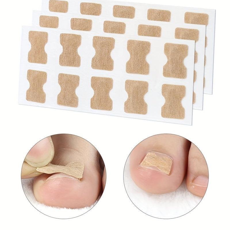 Ingrown Toenail Correction Sticker Professional Pedicure Tool