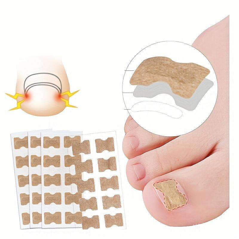 Ingrown Toenail Correction Sticker Professional Pedicure Tool