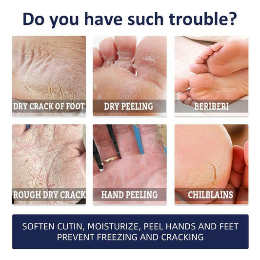 30g Hand and Foot Cream for Dry Cracked Heel Moisturizing Exfoliating Callus