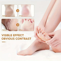 Vanilla Foot Cream For Dry Skin - Callus Remover Intense Moisturizer