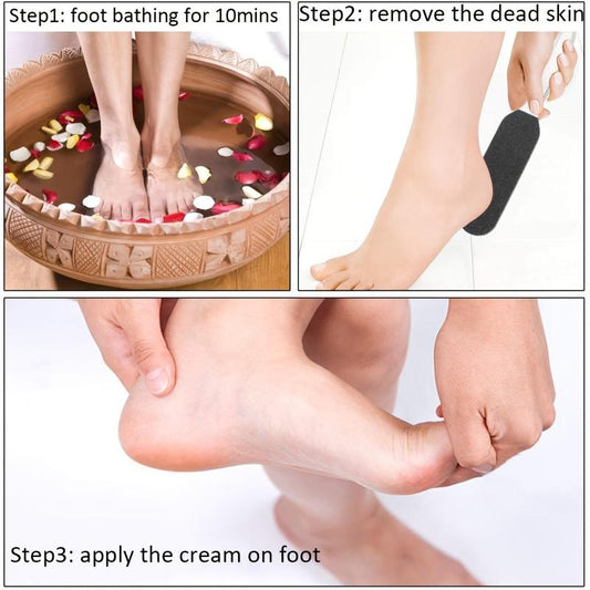 Stainless Steel Foot Scrubber for Callus Removal and Pedicure