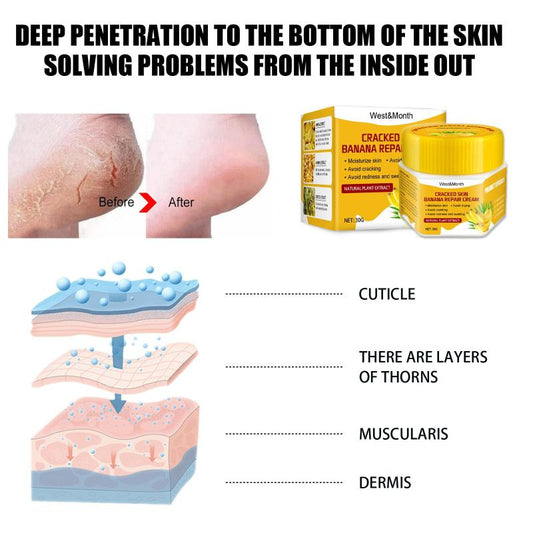 Banana Foot Cream Nourishing & Softening Dead Skin 30g