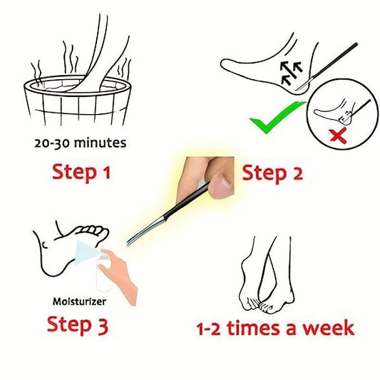 Stainless Steel Feet Scraper Manicure Pedicure Exfoliates Calluses