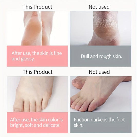 Urea Foot Cream for Dry Cracked Skin - Moisturize and Nourish Your Feet