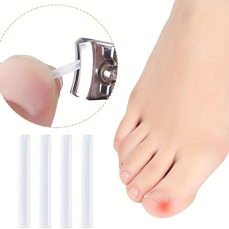 Ingrown Toenail Corrector Strips Foot Tool Nail Art Sets