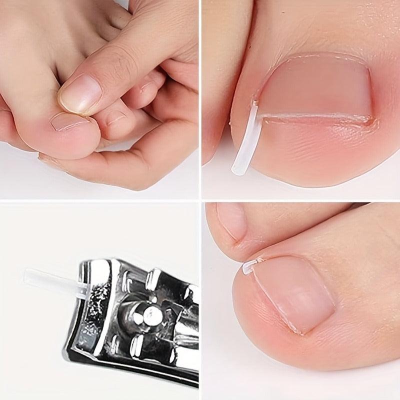 Ingrown Toenail Corrector Strips Foot Tool Nail Art Sets