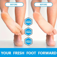 Moisturizing Cream For Dry Rough Cracked Skin - Prevent Dry Cracking