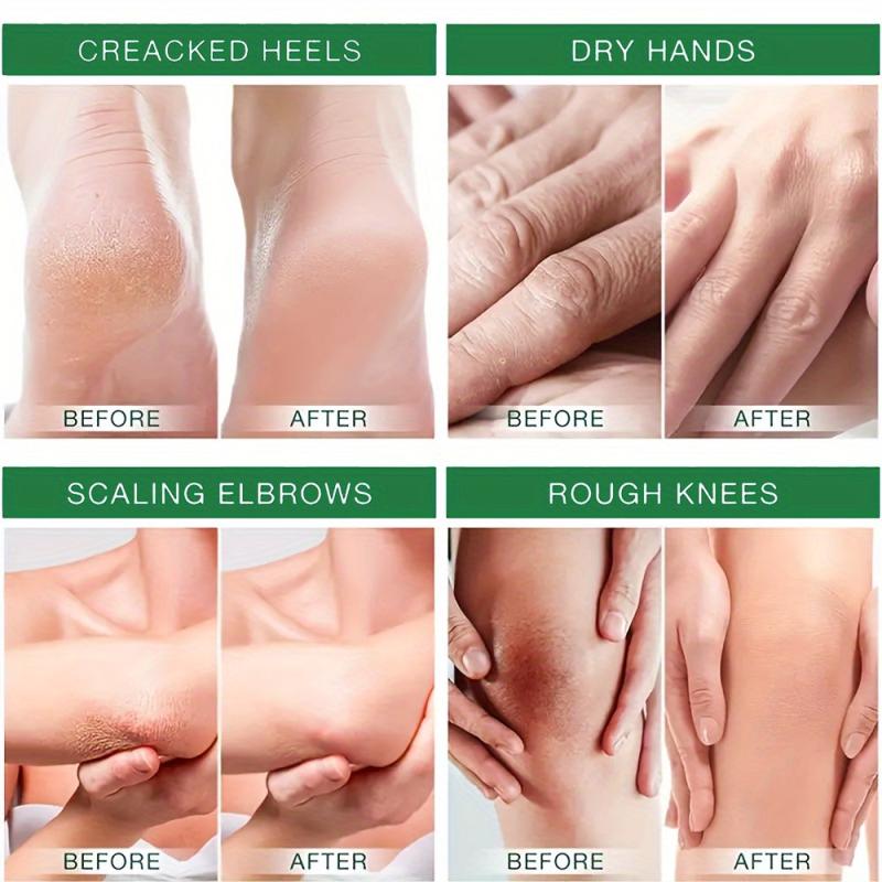 Tea Tree Cream for Face Neck Body Hand Foot