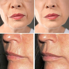 2pcs Silicone Wrinkle Lip Patch for Face Lifting & Repair